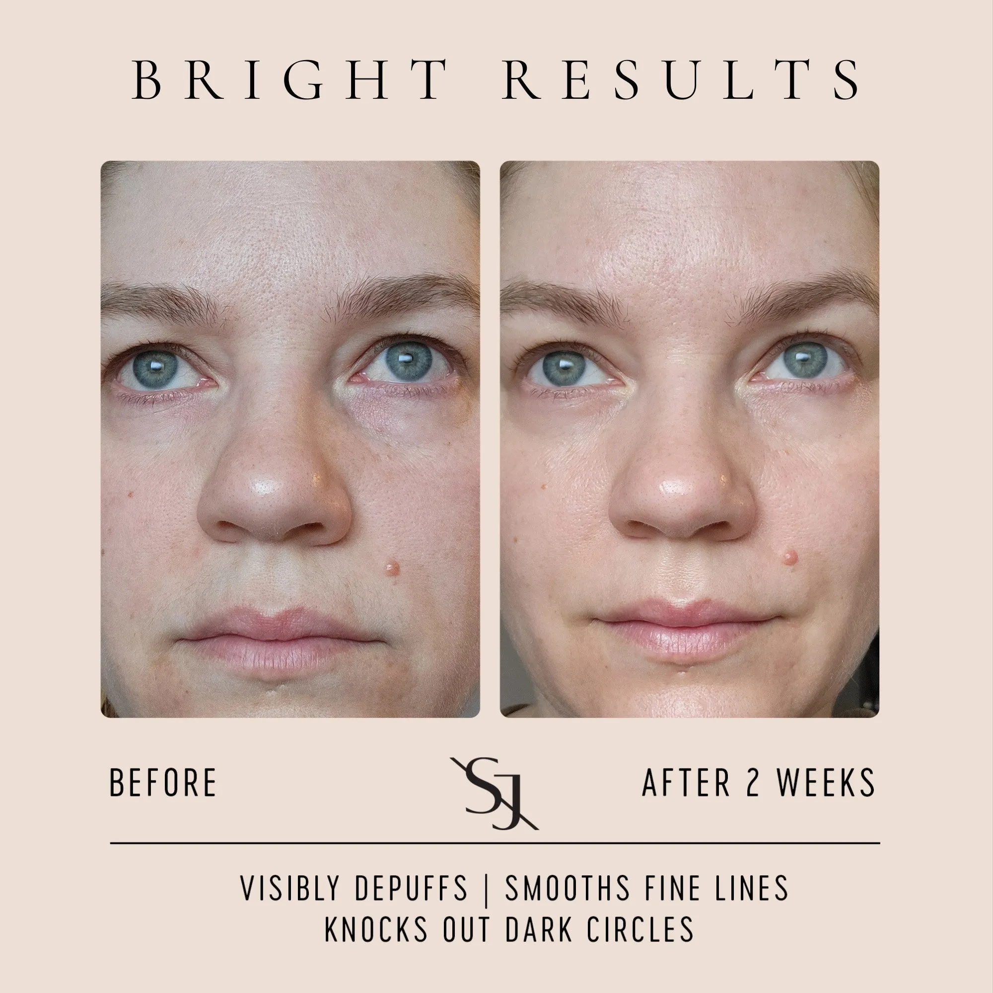 Bright Repair Eye Cream - Brightening Vitamin C, Green Tea   Plant Collagen